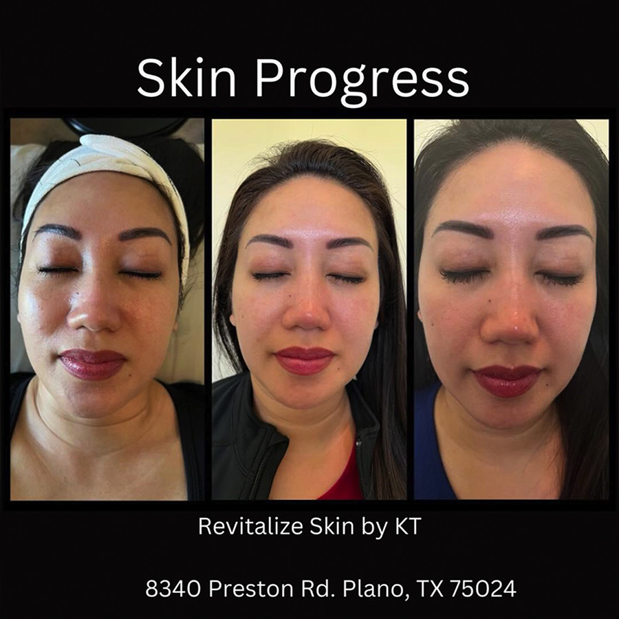 REVITALIZE SKIN BY KT - Best day spa Plano, TX 75024